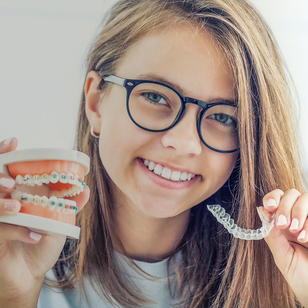 Clear Aligners- What are they and how do they work?